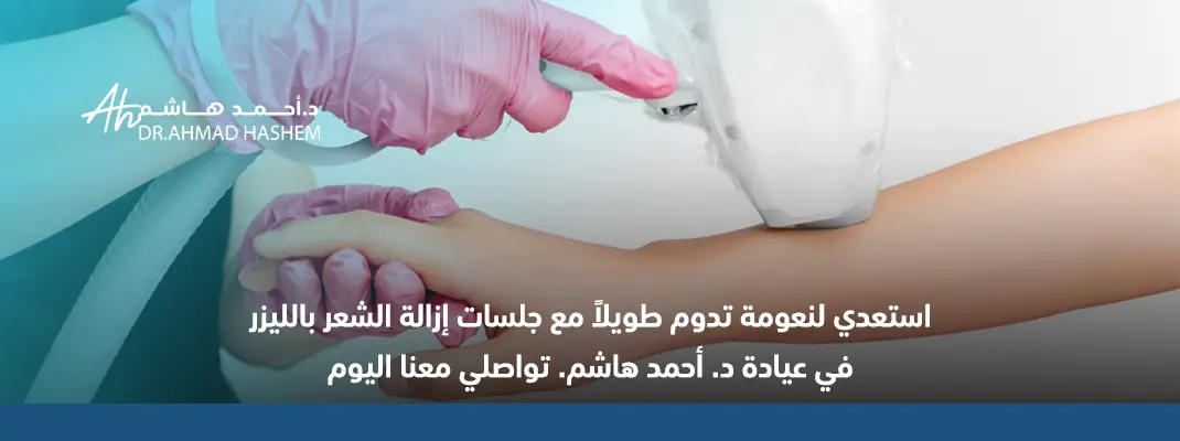 ليزر إزالة الشعر