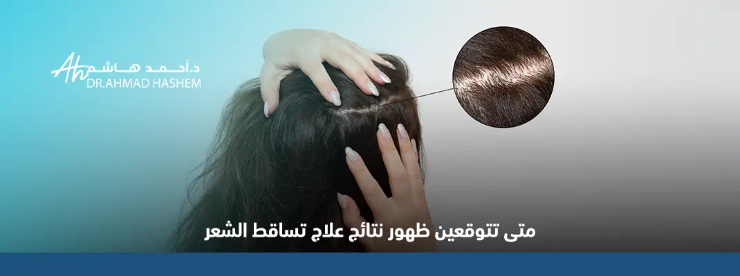 علاج تساقط الشعر​