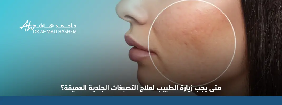 متى-يجب-زيارة-الطبيب-لعلاج-التصبغات-الجلدية-العميقة؟.webp