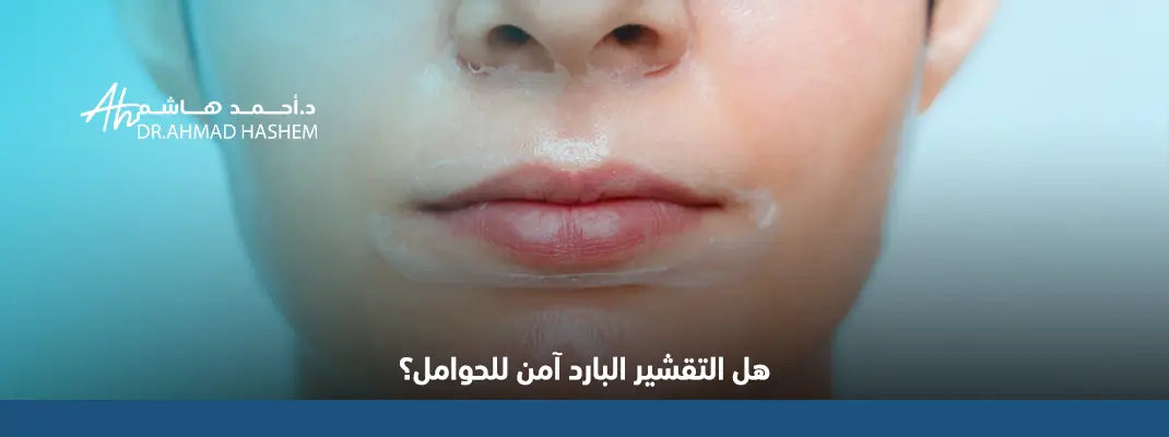 التقشير البارد للوجه