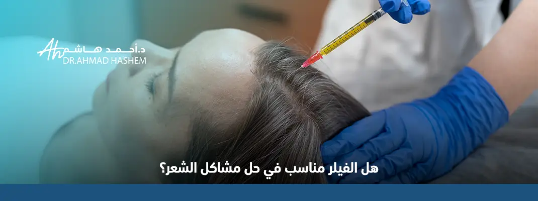 فوائد فيلر الشعر​