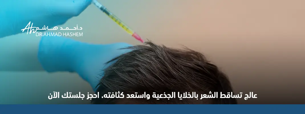 أنواع الخلايا الجذعية للشعر