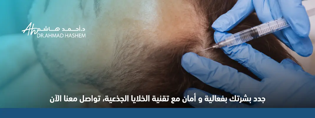 الخلايا الجذعية للوجه