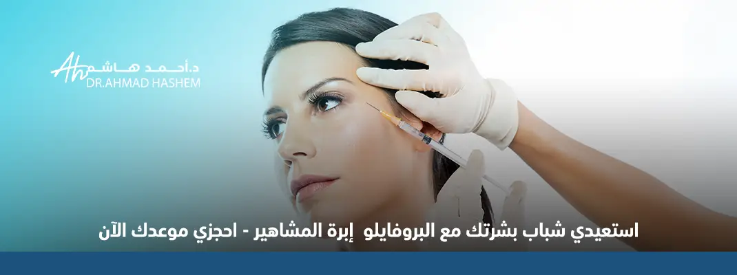 إبرة البروفايلو