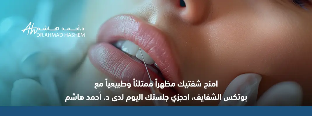 بوتكس شفايف