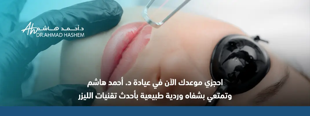 توريد الشفايف بالليزر