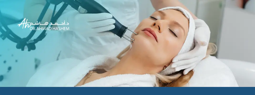 ليزر الأوعية الدموية