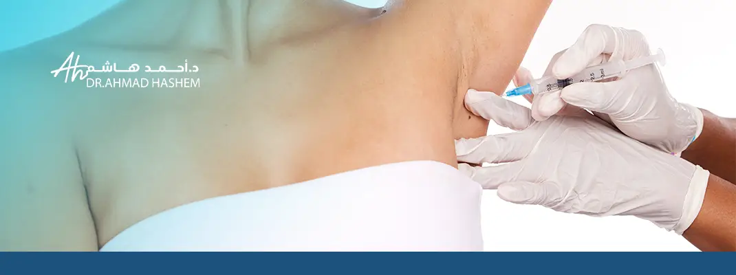 ما هو بوتكس التعرق​