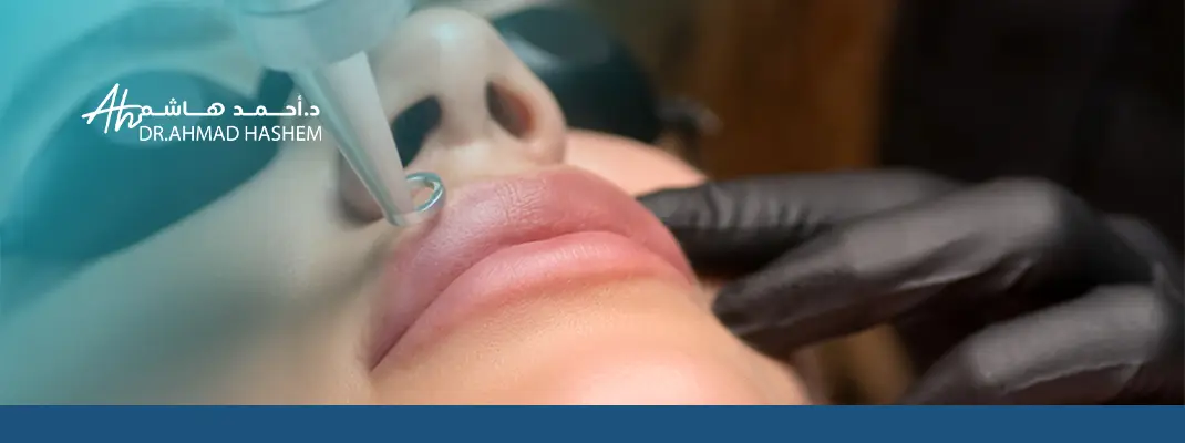 توريد الشفايف بالليزر