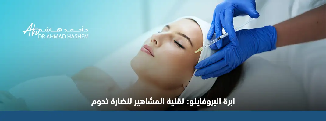 إبرة البروفايلو