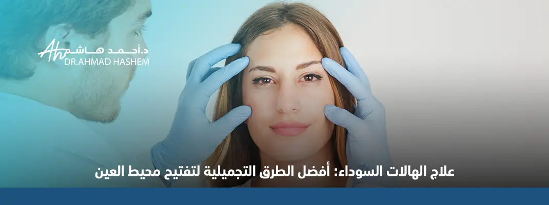 علاج الهالات السوداء