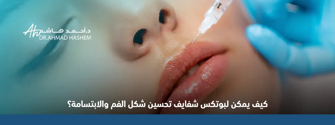 بوتكس شفايف