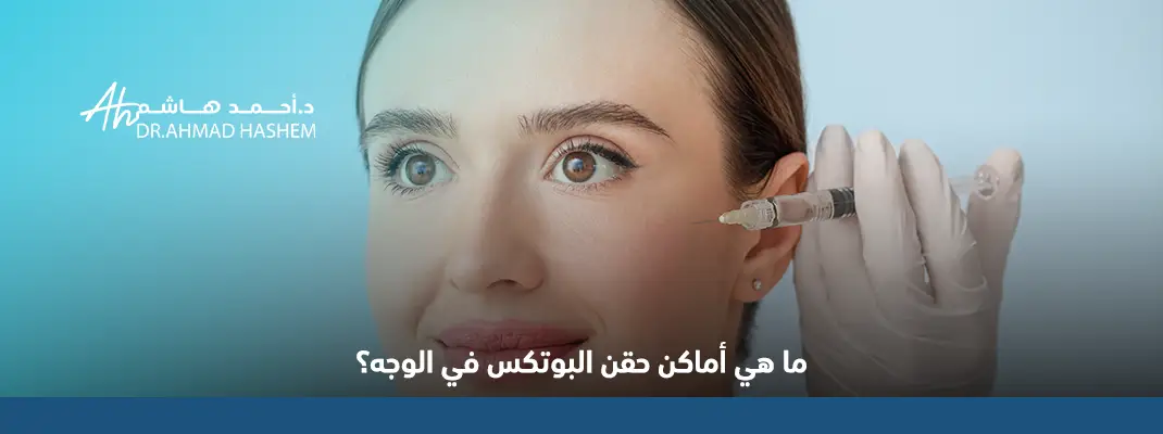 ما-هي-أماكن-حقن-البوتكس-في-الوجه؟.webp