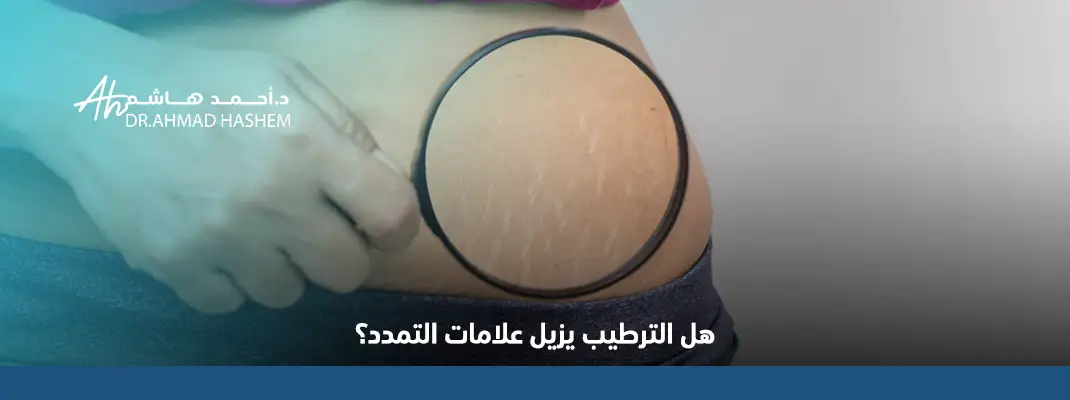 علاج علامات التمدد الحمراء والبيضاء