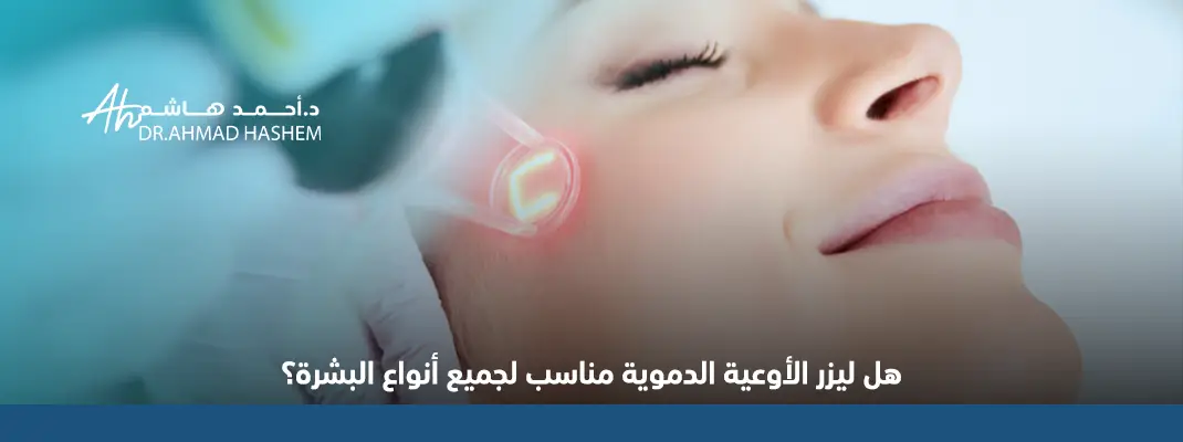 هل-ليزر-الأوعية-الدموية-مناسب-لجميع-أنواع-البشرة؟.webp