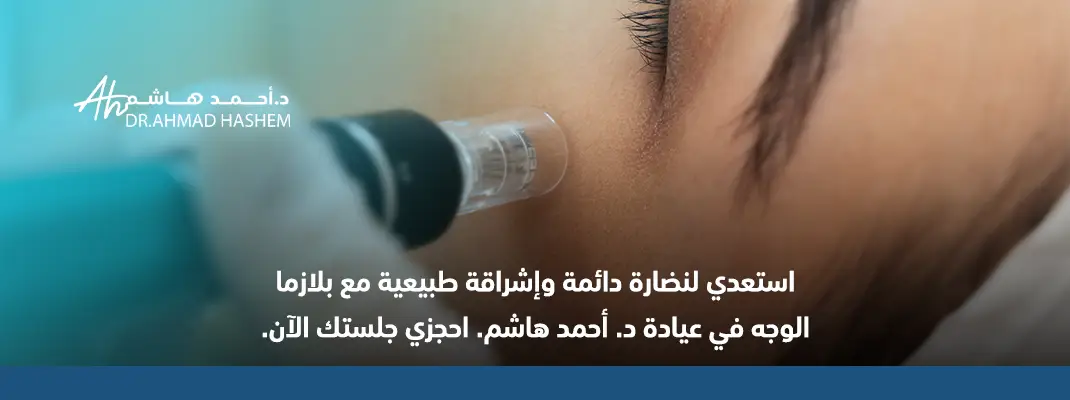 بلازما الوجه