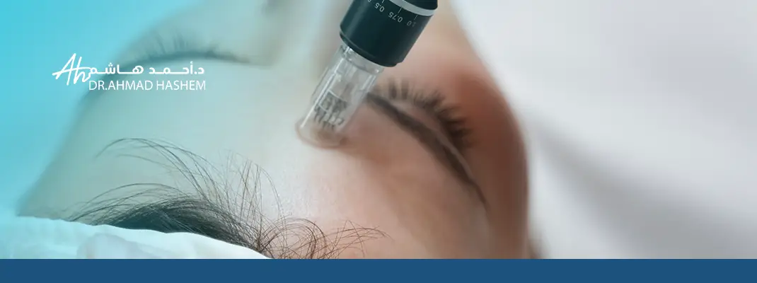 بلازما الوجه