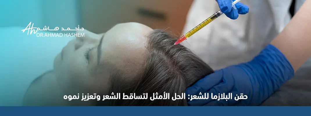 حقن البلازما للشعر