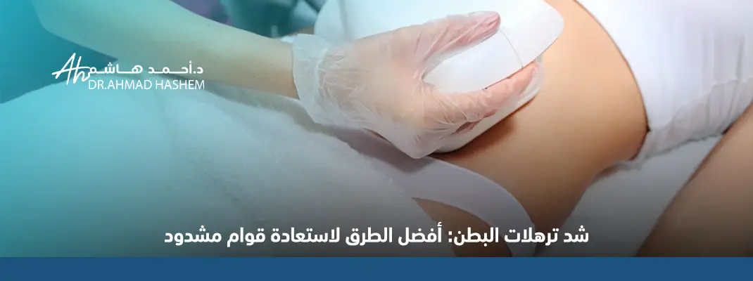 شد ترهلات البطن