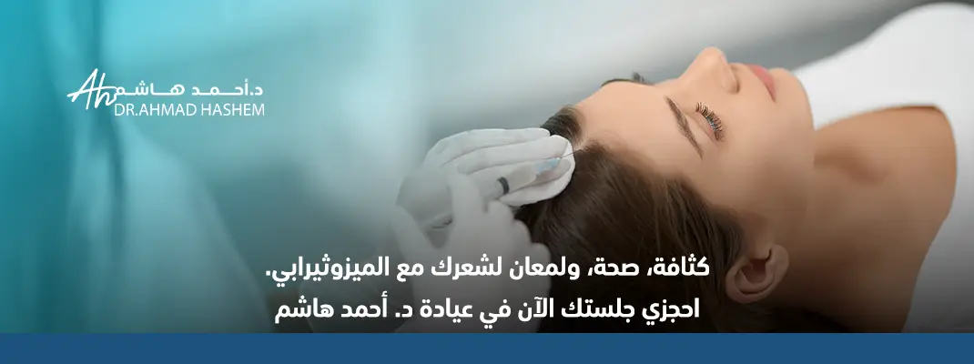 حقن الميزوثيرابي للشعر