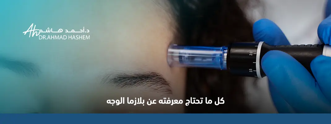 بلازما الوجه