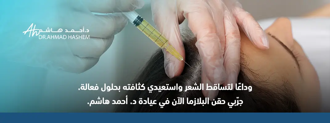 حقن البلازما للشعر
