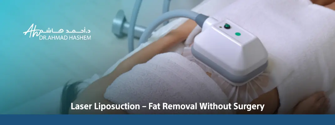 Laser-Liposuction-–-Fat-Removal-Without-Surgery.webp