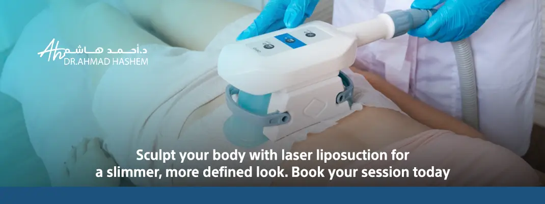 Laser Liposuction