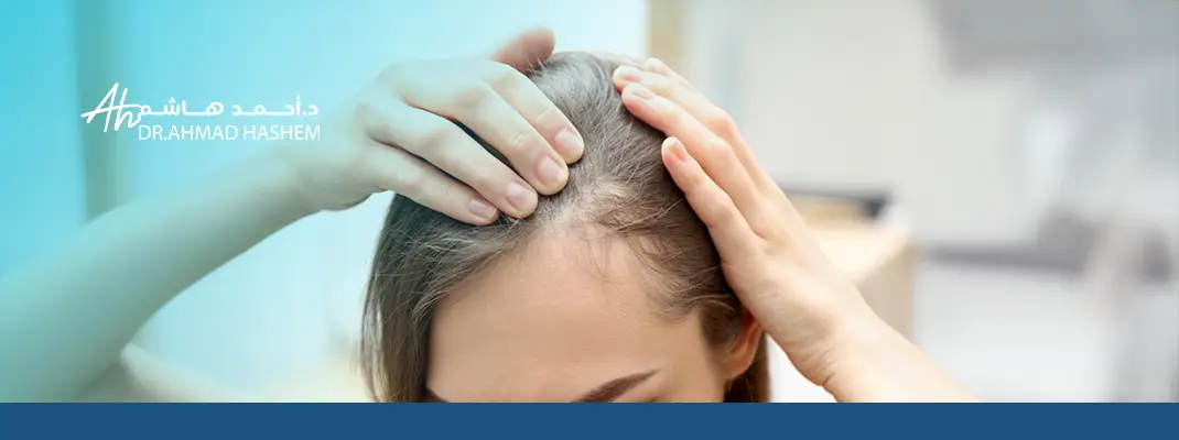 أسباب ثعلبة الشعر