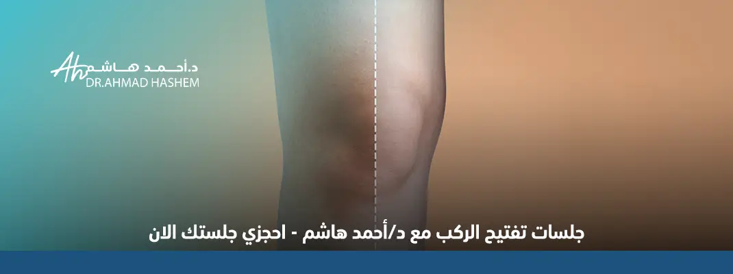 جلسة تفتيح الركب