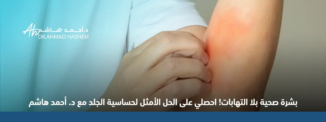 علاج التهاب الجلد