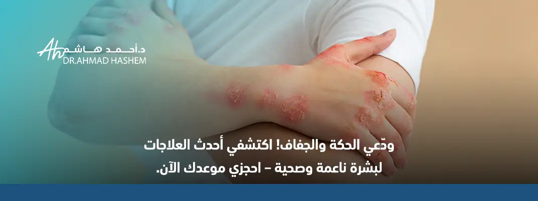 علاج أكزيما الجلد