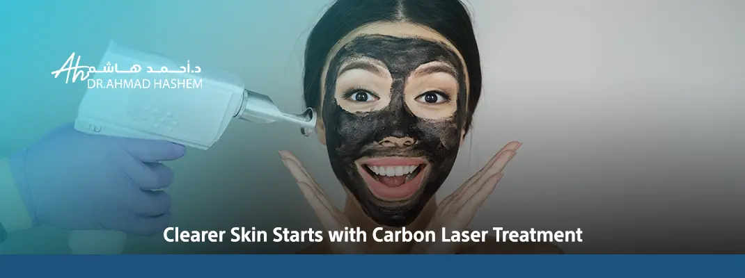carbon laser benefits