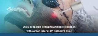 carbon laser benefits 