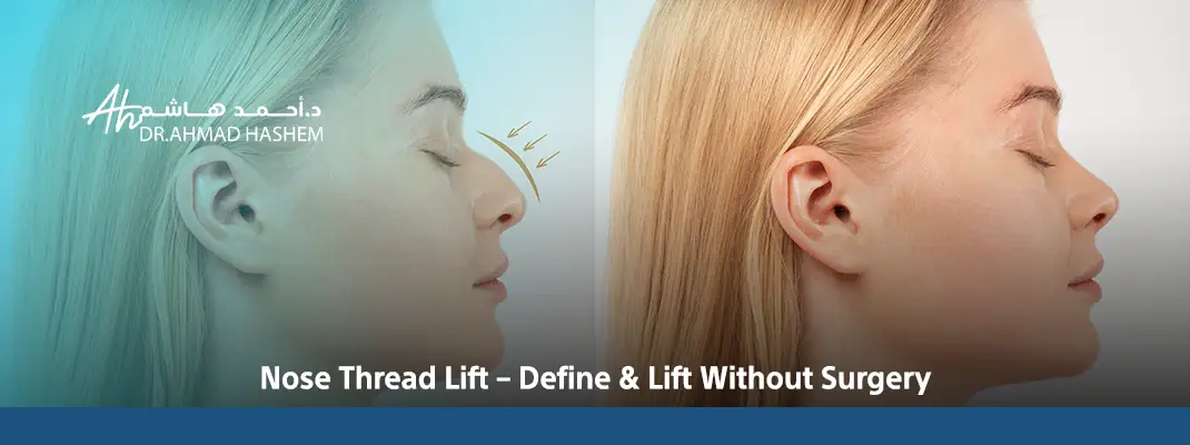 Nose-Thread-Lift-–-Define-Lift-Without-Surgery.webp
