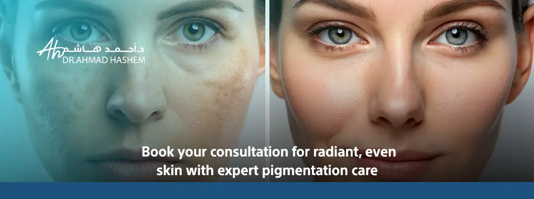 skin pigmentation​ Treatment