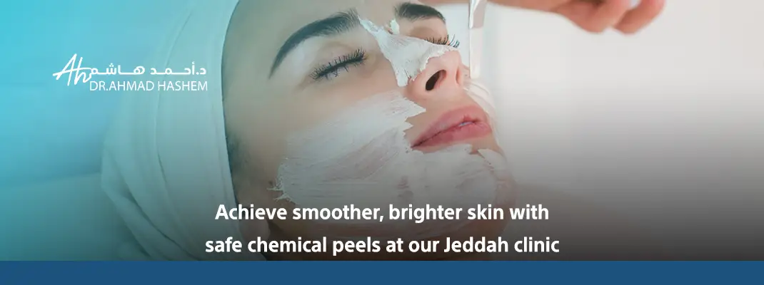 types of chemical peels