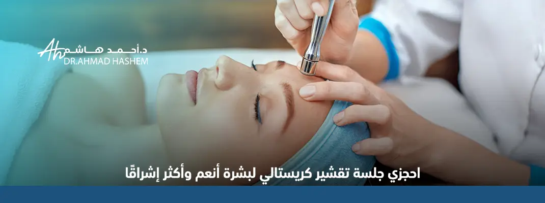 تقشير كريستالي