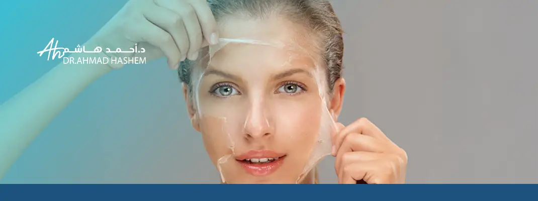 تقشير كريستالي