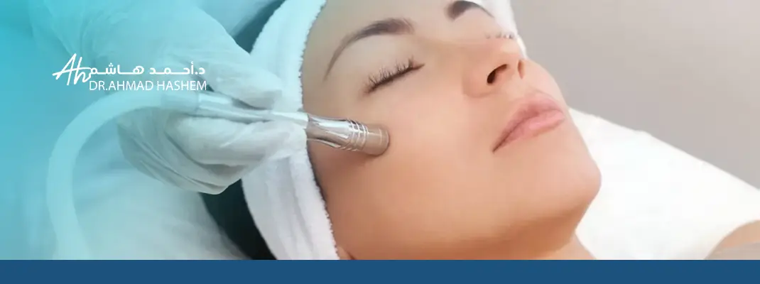 تقشير كريستالي