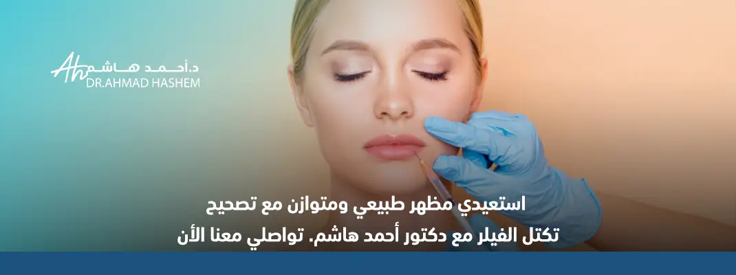 تكتل الفيلر