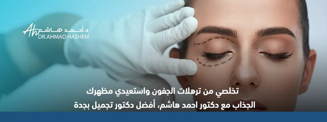 جراحة الجفون التجميلية