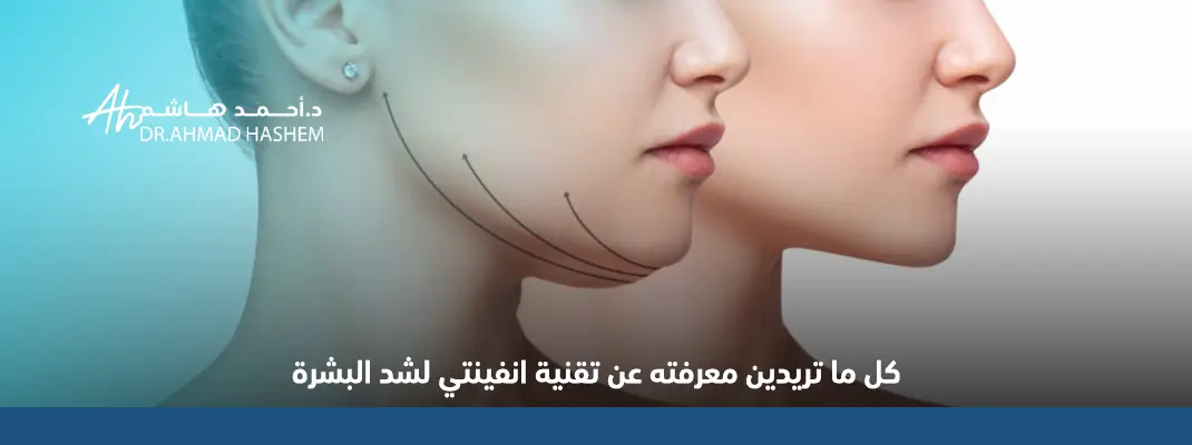 تقنية انفيني