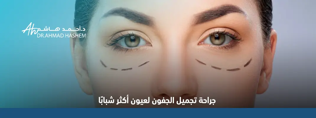 جراحة-تجميل-الجفون-لعيون-أكثر-شبابًا.webp