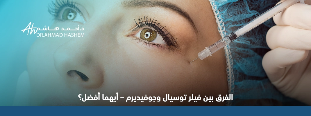 أيهما افضل فيلر توسيال او جوفيديرم؟