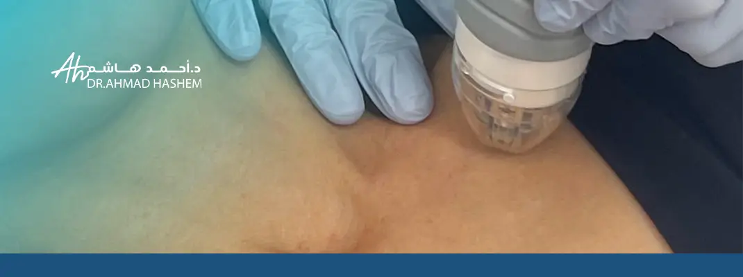 أسباب اسمرار الرقبة