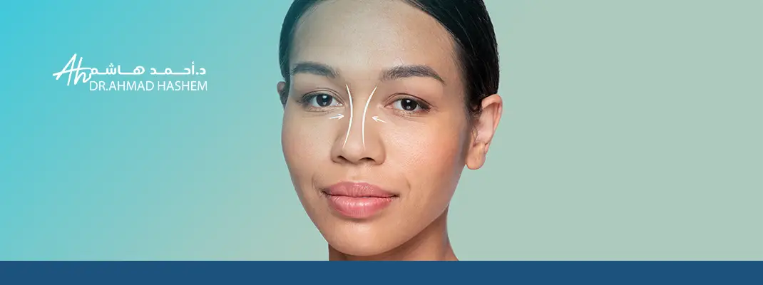 تجربتي مع عملية تجميل الأنف فتاة يتم توضيح شكل تأثير العملية عليها