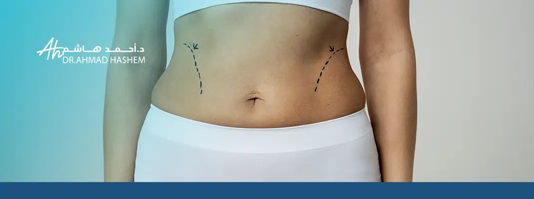 تجربتي مع عملية شد البطن
