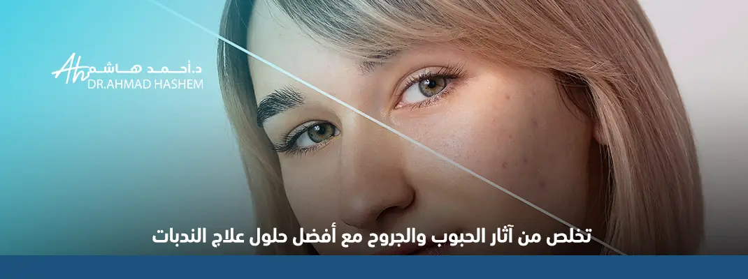 تخلص من آثار الحبوب والجروح مع أفضل حلول علاج الندبات 1