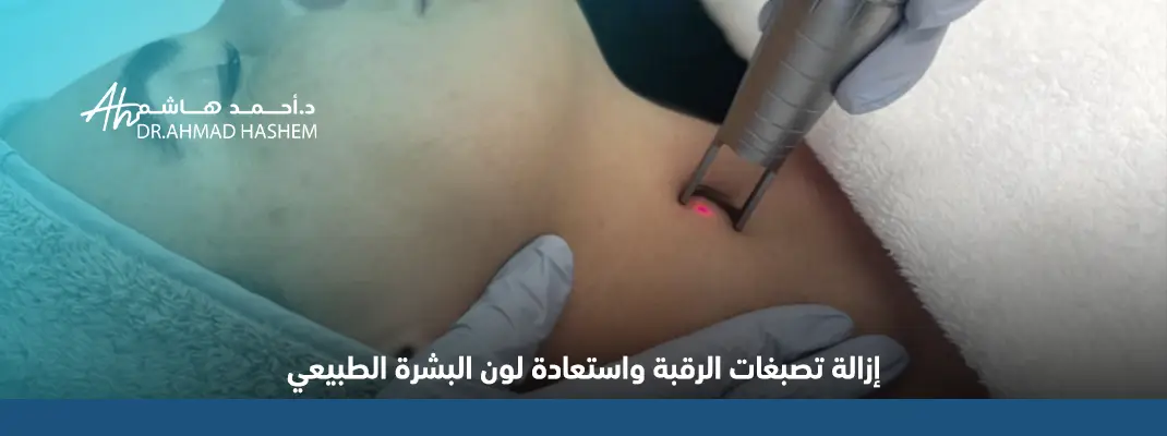 تصبغات الرقبة​